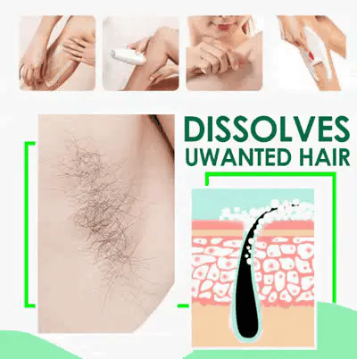 Sydonic hair Removal Treatment