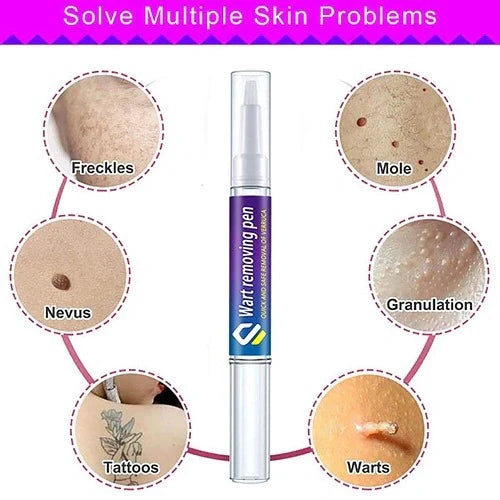 Warts & Moles Remover Pen